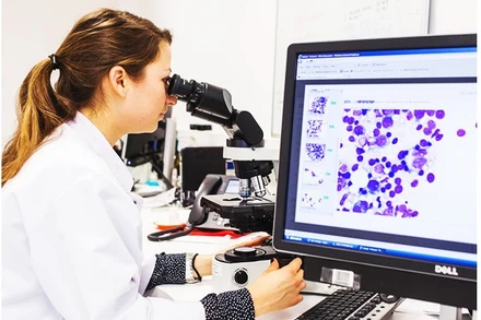 Nghiên cứu điều trị bệnh bạch cầu lymphocytic mãn tính. Ảnh: ALARMY