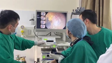 Các bác sĩ Bệnh viện 19-8 nội soi cắt tách dưới niêm mạc điều trị ung thư dạ dày sớm cho bệnh nhân. (Ảnh: cand.com.vn)