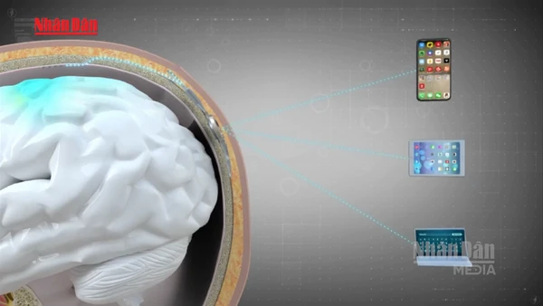 [Video] Trung Quốc cho phép loại chip gắn não đầu tiên được sử dụng lâm sàng 
