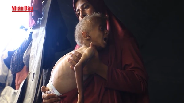 [Video] UNICEF báo động tình trạng trẻ em Dải Gaza suy dinh dưỡng nặng dù đã ngừng bắn 