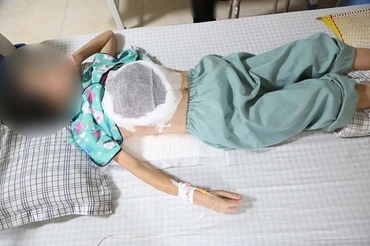 Cẩn thận khi dùng thuốc nam chữa ung thư