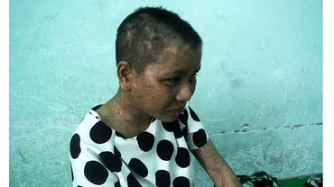 Chị Y Nhiêu, người làm thuê bị bạo hành tại Gia Lai. (Ảnh: Báo Gia Lai).