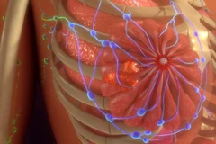 Tìm ra giải pháp tối ưu hóa thuốc điều trị ung thư vú Tamoxifen