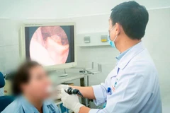 Bác sĩ nội soi thanh quản cho người bệnh sau thời gian điều trị.