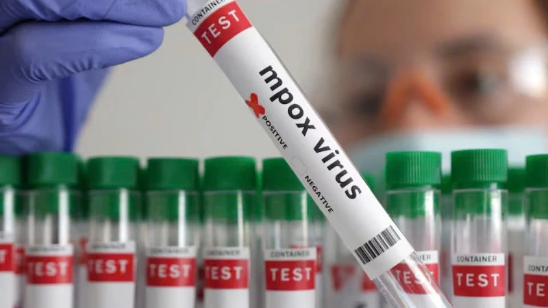 Xét nghiệm đậu mùa khỉ. Ảnh: Reuters