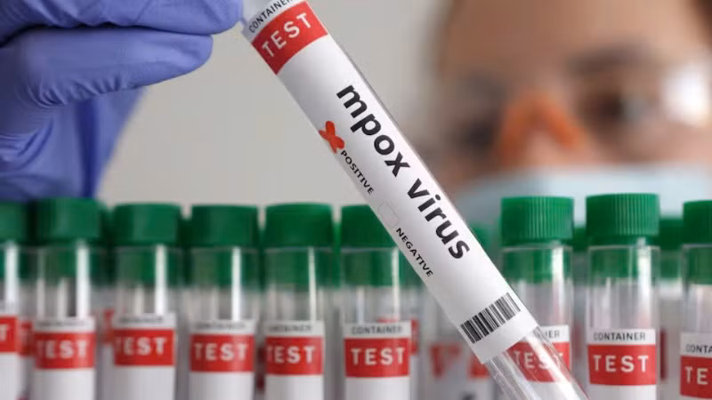 Xét nghiệm đậu mùa khỉ. Ảnh: Reuters