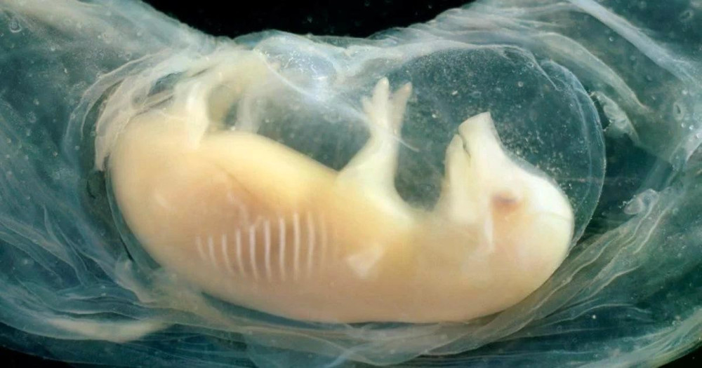 Phôi lợn có tế bào tim người đã sống sót trong 21 ngày. (Nguồn: Science Photo)