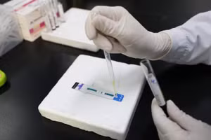 Bác sĩ xét nghiệm mẫu bệnh phẩm để phát hiện HIV/AIDS tại Bệnh viện Nhân dân số 4 Nam Ninh, thành phố Nam Ninh, Khu tự trị dân tộc Choang Quảng Tây, Trung Quốc, ngày 21/11/2024. (Ảnh: Tân Hoa Xã)