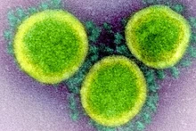 Hình ảnh các hạt virus SARS-CoV-2 qua kính hiển vi điện tử. Ảnh: NIAID.