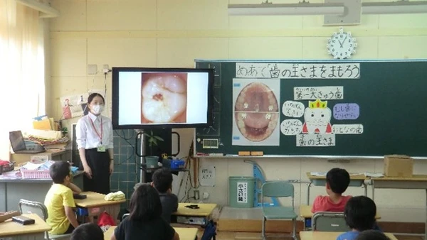 Tại Nhật Bản, Yogo Teachers - Giáo viên y tế học đường được công nhận như một giáo viên chuyên môn. 