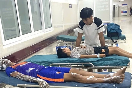 4 học sinh ở Quảng Bình phải nhập viện cấp cứu do làm pháo theo hướng dẫn trên Youtube.