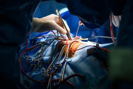 [Ảnh] Cận cảnh ca mổ thứ 700 trường hợp tim bẩm sinh với kỹ thuật ít xâm lấn