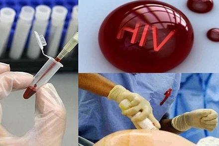 Điều kiện xác định người bị phơi nhiễm HIV, người bị nhiễm HIV do tai nạn rủi ro nghề nghiệp. (Ảnh: chinhphu.vn)