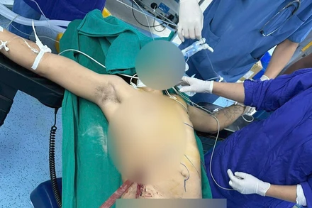 Nam thanh niên với vết thương thấu bụng-ngực do tai nạn lao động.