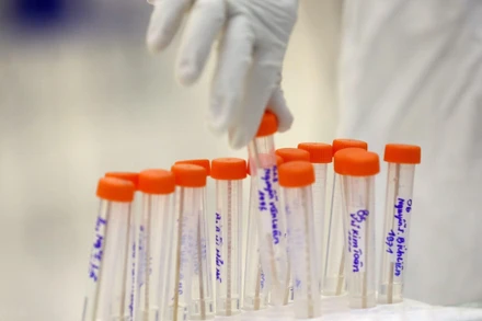 Theo đánh giá của Bộ Y tế, hiện nay tình hình dịch Covid-19 tiếp tục diễn biến phức tạp. (Ảnh: TTXVN/Vietnam+)