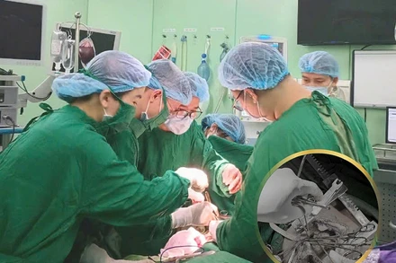 Kíp cấp cứu phẫu thuật cứu sống người bệnh. (Ảnh: Từ Thành)