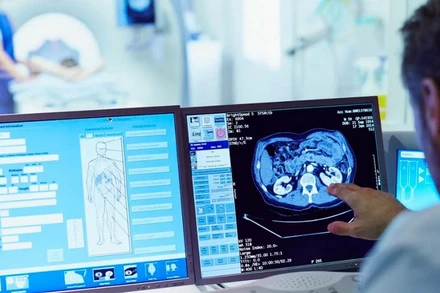 Đột quỵ là nguyên nhân gây tử vong đứng thứ 5 ở Mỹ nói chung. (Ảnh: Getty images)