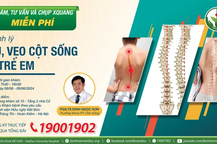 Bệnh viện Hữu nghị Việt Đức khám sàng lọc miễn phí và phẫu thuật điều trị gù vẹo cột sống ở trẻ em