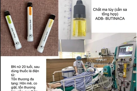 Một bệnh nhân cấp cứu tại Trung tâm chống độc sau khi dùng thuốc lá điện tử có chất ma túy.