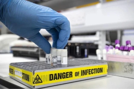 [Video] Trang web Nhà Trắng: Covid 19 “rò rỉ từ phòng thí nghiệm”