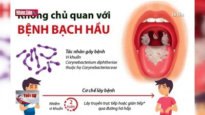 Bắc Giang khống chế không để dịch bạch hầu lây lan
