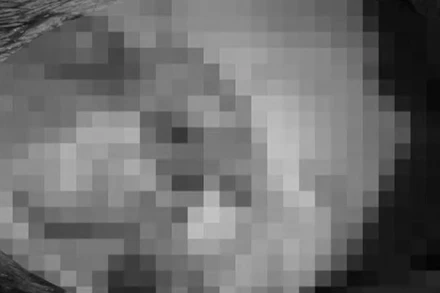 Hình ảnh tai bị đứt rời gần hoàn toàn.