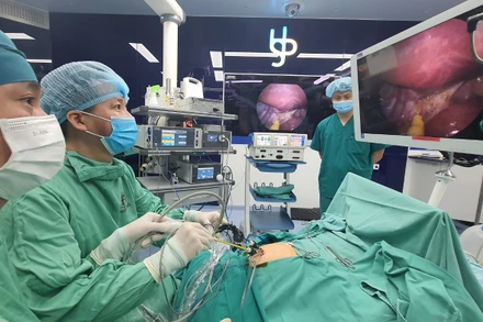 PGS,TS Trần Ngọc Sơn và kíp mổ đang thực hiện ca phẫu thuật nội soi một lỗ.