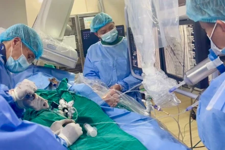 Các bác sĩ đang thực hiện ca can thiệp.