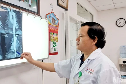 Bác sĩ hội chẩn về hiện trạng khối phổi biệt lập của bệnh nhân trên hình ảnh phim chụp CT Scan. (Ảnh: ANH ĐÀO)