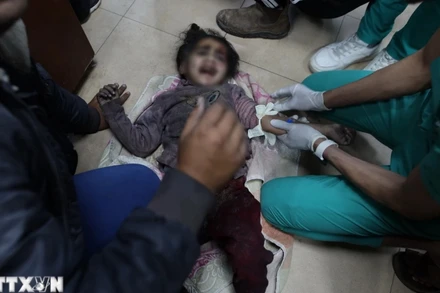 Một em nhỏ bị thương sau cuộc tấn công của Israel được đưa tới bệnh viện ở Deir el-Balah, Dải Gaza ngày 8/3/2024. (Ảnh: THX/TTXVN)