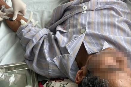 Bệnh nhân được điều trị tại Bệnh viện Bệnh Nhiệt đới Trung ương. 