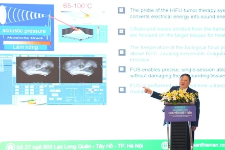 Giáo sư, Tiến sĩ Nguyễn Viết Tiến, nguyên Thứ trưởng Y tế chia sẻ về kỹ thuật mới điều trị khối u. 