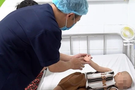 Bệnh nhi mắc tay chân miệng điều trị tại Bệnh viện Nhi Trung ương.