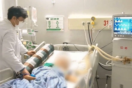 Bệnh nhân điều trị tại Bệnh viện Bệnh Nhiệt đới Trung ương.