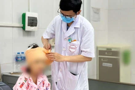 Bệnh nhi bị chó nhà cắn vào vùng đầu mặt.