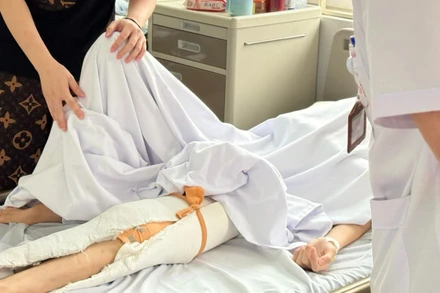 Bệnh nhân điều trị tại Bệnh viện Bệnh Nhiệt đới Trung ương.