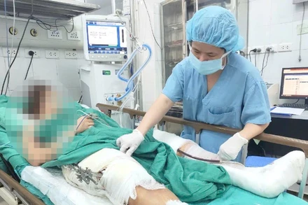 Bệnh nhân Nguyễn Thị N. (32 tuổi; Gia Lộc, Hải Dương) chẩn đoán đa chấn thương, đang được chăm sóc tại khoa Hồi tỉnh 3, Trung tâm Gây mê và Hồi sức Ngoại khoa. 