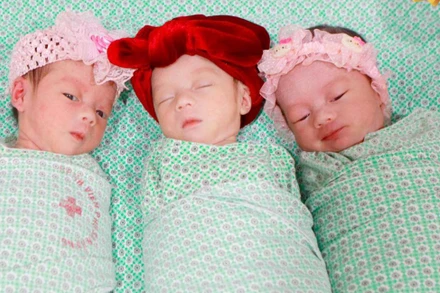 Sản phụ sinh 3 con có chung 1 bánh rau hiếm gặp