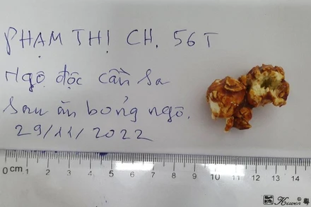 Mẫu bỏng ngô bệnh nhân đã sử dụng do gia đình cung cấp.