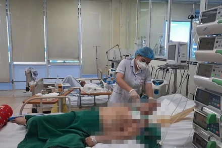 Bệnh nhân Covid-19 nặng đang điều trị tại Bệnh viện Bệnh Nhiệt đới Trung ương. (Ảnh: TĐ)