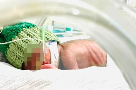 Bé trai chào đời chỉ nặng 460g.