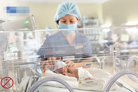 Điều dưỡng Phương chăm sóc trẻ sinh non. 
