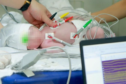 Bệnh nhi được cứu sống kịp thời.