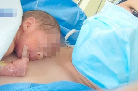 Em bé được ấp kangaroo với mẹ. 