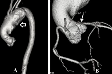 Hình ảnh trước mổ của bệnh nhân.(Ảnh: BVCC)