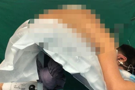 Bệnh nhân được phẫu thuật chỉnh cột sống.