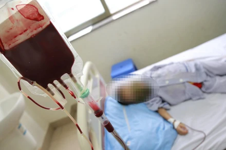 Bệnh nhi thalassemia phải truyền máu định kỳ. 