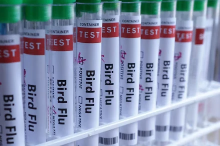 Xét nghiệm cúm gia cầm. Ảnh: Reuters