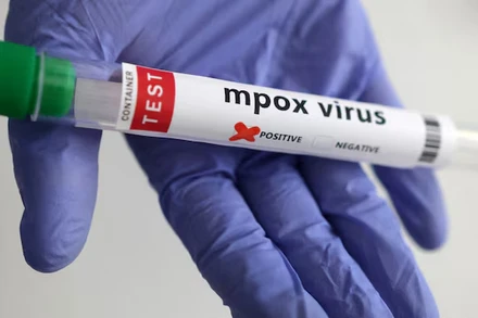 Xét nghiệm virus đậu mùa khỉ. Ảnh: Reuters