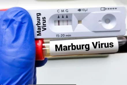 Ống xét nghiệm virus Marburg. Ảnh: Tân Hoa xã
